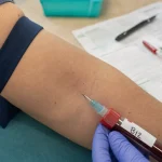 Vitamine B12 prise de sang : résultat et taux bas